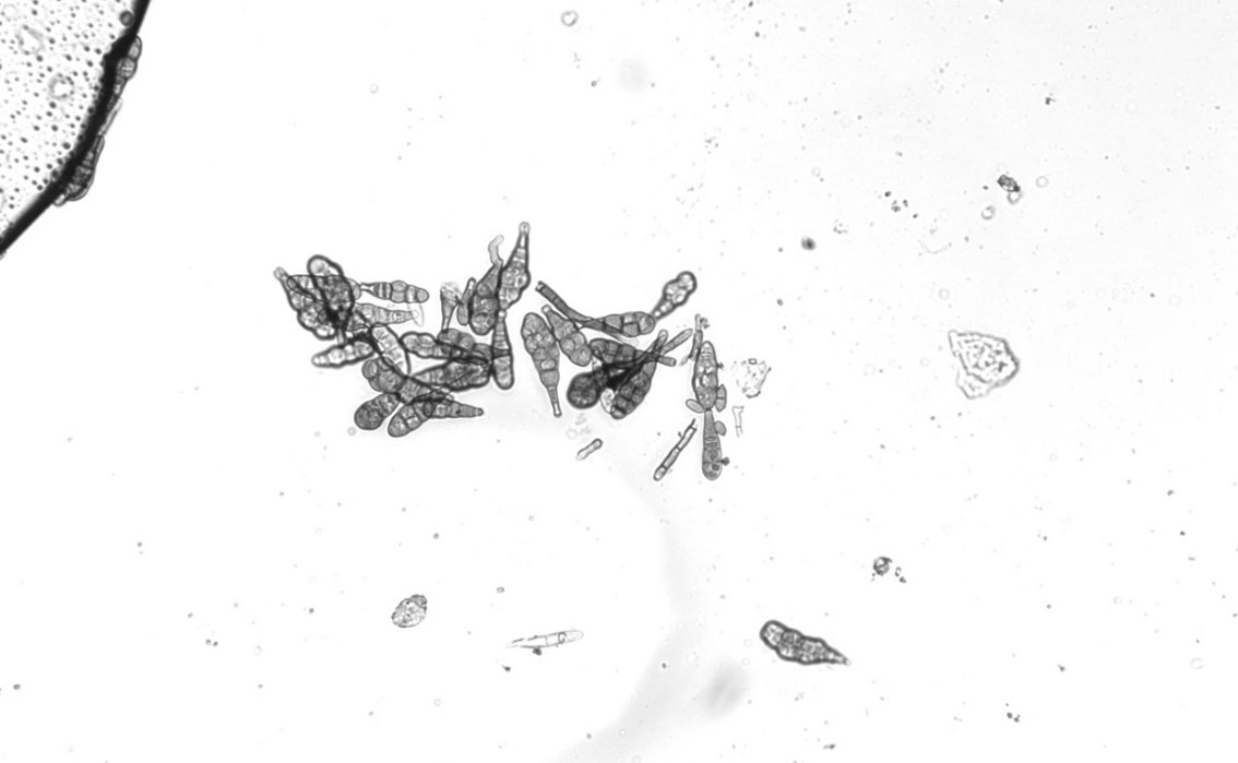 A magnified image of the pathogen that causes Alternaria leaf spot, in black and white.